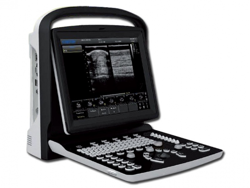 chisoneco1plusportableultrasoundmachine-800x600 Chison ECO-1 Portable Ultrasound